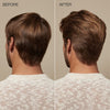 Tea Tree Scalp Care Regeniplex Root Lift Foam